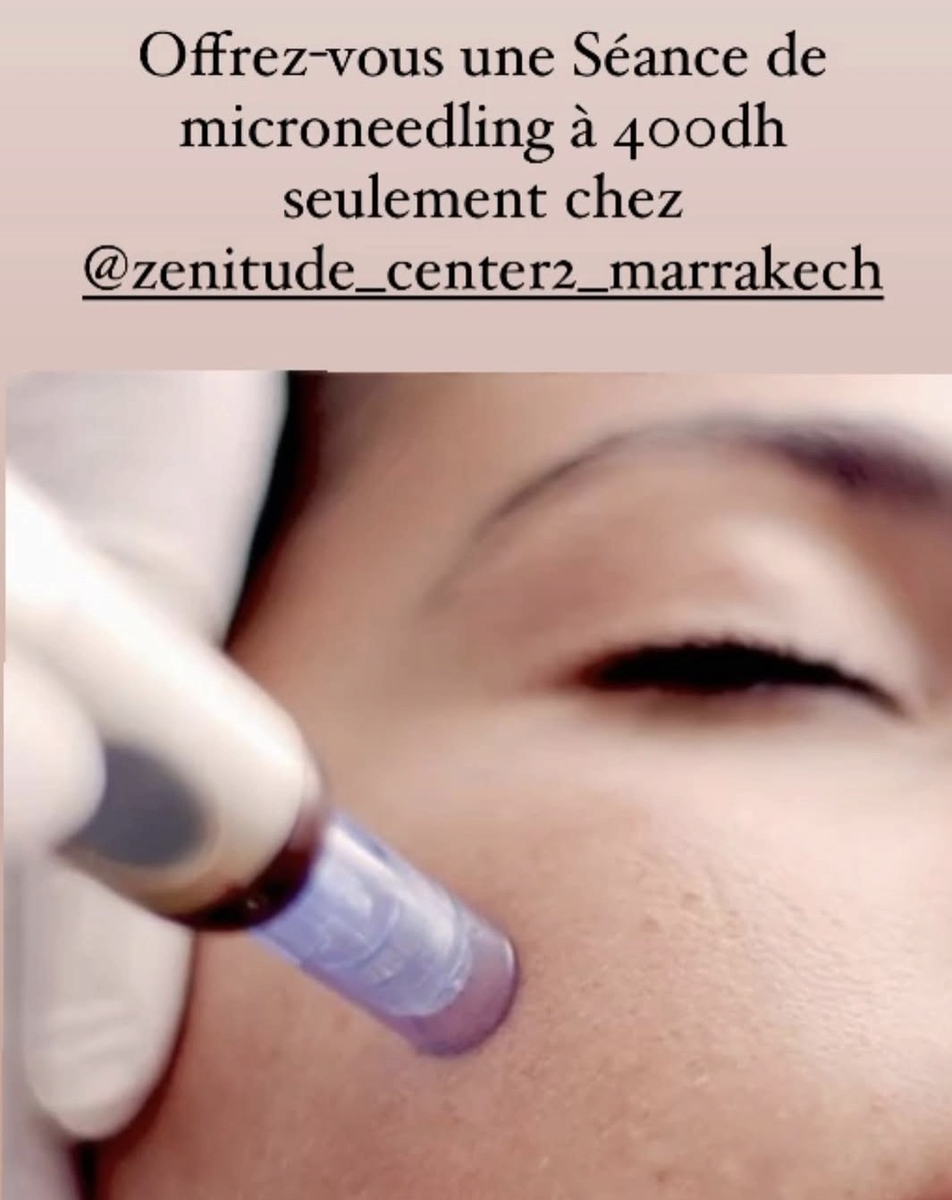 Nettoyage de peau Zenitude Center